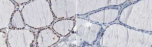 Anti-SETD8/KMT5A Antibody, clone 5L10 ZooMAb&#174; Rabbit Monoclonal recombinant, expressed in HEK 293 cells
