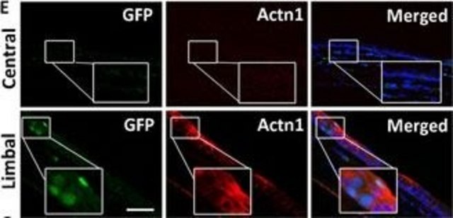 Anti-ACTN1 antibody produced in rabbit Prestige Antibodies&#174; Powered by Atlas Antibodies, affinity isolated antibody, buffered aqueous glycerol solution