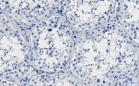 Anti-SMARCA2 Antibody, clone 3E14 ZooMAb&#174; Rabbit Monoclonal recombinant, expressed in HEK 293 cells
