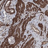 Anti-CCDC82 antibody produced in rabbit Prestige Antibodies&#174; Powered by Atlas Antibodies, affinity isolated antibody, buffered aqueous glycerol solution