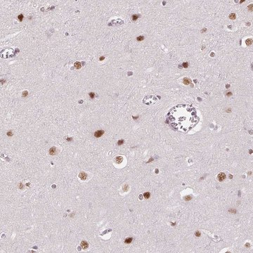 Anti-HNRNPDL antibody produced in rabbit Prestige Antibodies&#174; Powered by Atlas Antibodies, affinity isolated antibody, buffered aqueous glycerol solution