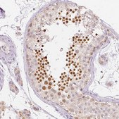 Anti-NVL antibody produced in rabbit Prestige Antibodies&#174; Powered by Atlas Antibodies, affinity isolated antibody, buffered aqueous glycerol solution