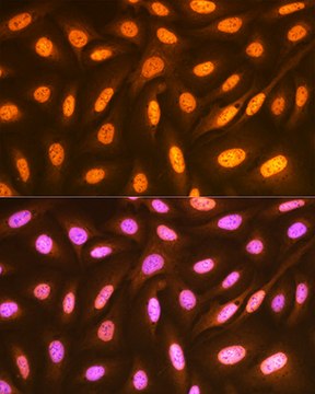 Anti-FUBP1 Antibody, clone 1G6X5, Rabbit Monoclonal
