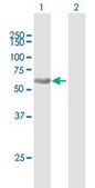 Anti-SQSTM1 antibody produced in mouse purified immunoglobulin, buffered aqueous solution
