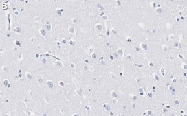Anti-ADAM10 Antibody, clone 1F3 ZooMAb&#174; Rabbit Monoclonal recombinant, expressed in HEK 293 cells