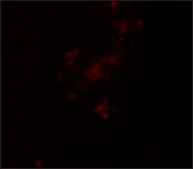 Anti-ZBTB5 antibody produced in rabbit affinity isolated antibody, buffered aqueous solution