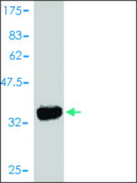 Monoclonal Anti-ROR1 antibody produced in mouse clone 2F8, purified immunoglobulin, buffered aqueous solution