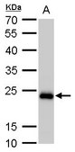 Monoclonal Anti-SOD2 antibody produced in mouse clone GT582, affinity isolated antibody