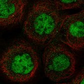 Anti-MSL1 antibody produced in rabbit Prestige Antibodies&#174; Powered by Atlas Antibodies, affinity isolated antibody, buffered aqueous glycerol solution, Ab2