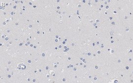 Anti-Nuclei Antibody, clone 3E1.3 ZooMAb&#174; Mouse Monoclonal recombinant, expressed in HEK 293 cells