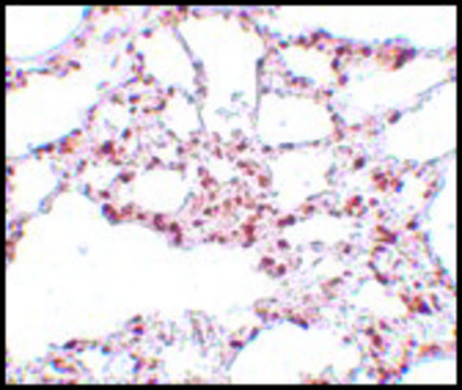 Anti-ZSCAN4 antibody produced in rabbit affinity isolated antibody, buffered aqueous solution