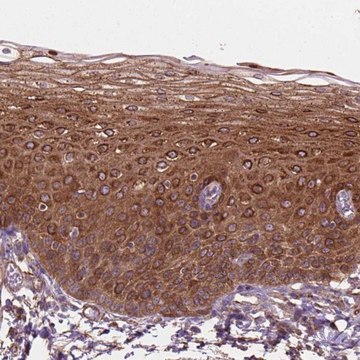 Anti-TCAF1 antibody produced in rabbit Prestige Antibodies&#174; Powered by Atlas Antibodies, affinity isolated antibody, buffered aqueous glycerol solution