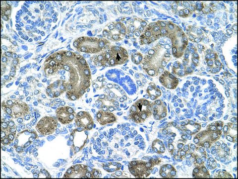 Anti-XTP3TPA (AB1) antibody produced in rabbit affinity isolated antibody