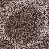 Anti-MATR3 antibody produced in rabbit Prestige Antibodies&#174; Powered by Atlas Antibodies, affinity isolated antibody, buffered aqueous glycerol solution