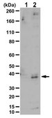 Anti-acetyl-GAPDH (Lys160) Antibody 0.5&#160;mg/mL, from rabbit