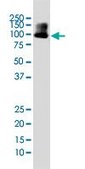 Monoclonal Anti-DYRK1A antibody produced in mouse clone 7D10, purified immunoglobulin, buffered aqueous solution