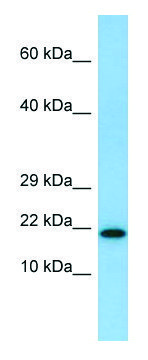 Anti-IL26 (N-terminal) antibody produced in rabbit affinity isolated antibody