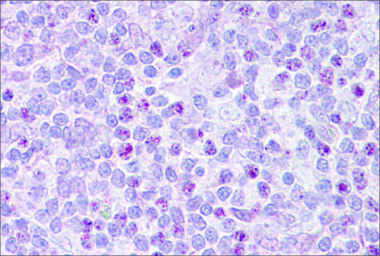 Anti-EBF1, (N-terminal) antibody produced in rabbit affinity isolated antibody