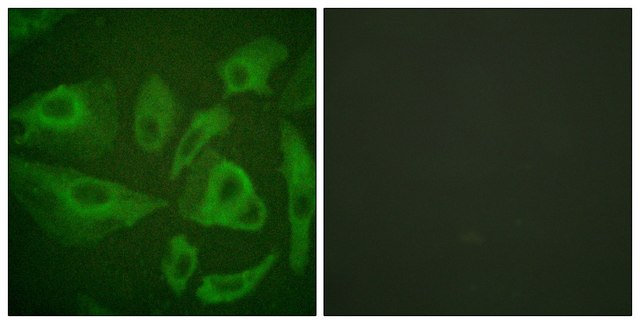 Anti-FAS antibody produced in rabbit affinity isolated antibody