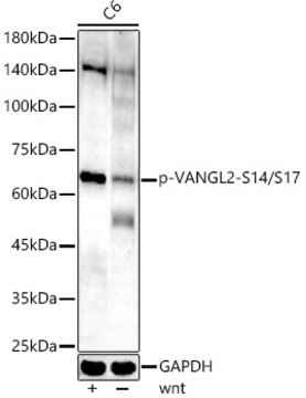 Anti-Phospho-VANGL2(pSer14/Ser17) Antibody, clone 4C7Y1, Rabbit Monoclonal