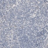 Anti-MT3 antibody produced in rabbit Prestige Antibodies&#174; Powered by Atlas Antibodies, affinity isolated antibody, buffered aqueous glycerol solution
