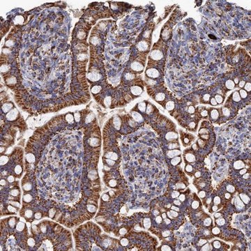 Anti-AQP11 antibody produced in rabbit Prestige Antibodies&#174; Powered by Atlas Antibodies, affinity isolated antibody, buffered aqueous glycerol solution