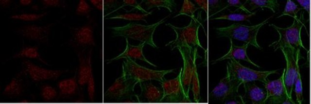 Anti-TFE3 from rabbit, purified by affinity chromatography