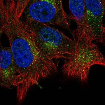 Anti-ABHD6 antibody produced in rabbit Prestige Antibodies&#174; Powered by Atlas Antibodies, affinity isolated antibody