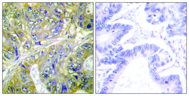 Anti-EPS8L3 antibody produced in rabbit affinity isolated antibody