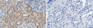 Anti-SLC5A2 Antibody, clone 2I4 ZooMAb&#174; Rabbit Monoclonal recombinant, expressed in HEK 293 cells