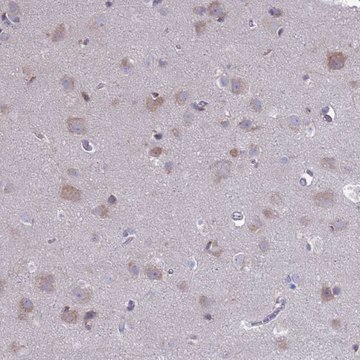 Anti-PET117 antibody produced in rabbit Prestige Antibodies&#174; Powered by Atlas Antibodies, affinity isolated antibody, buffered aqueous glycerol solution