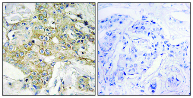 Anti-T4S1 antibody produced in rabbit affinity isolated antibody