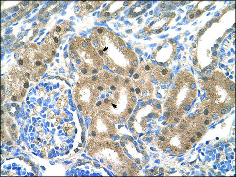 Anti-SLC39A6 antibody produced in rabbit IgG fraction of antiserum