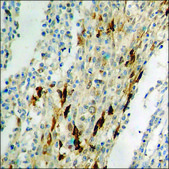 Anti-phospho-NF-kappaB p65 (pThr435) antibody produced in rabbit affinity isolated antibody