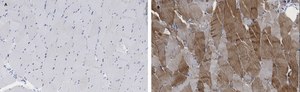 Anti-alpha Actinin 2 Antibody, clone 1E11, ZooMAb&#174; Rabbit Monoclonal recombinant, expressed in HEK 293 cells