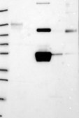 Anti-FGG antibody produced in rabbit Prestige Antibodies&#174; Powered by Atlas Antibodies, affinity isolated antibody, buffered aqueous glycerol solution