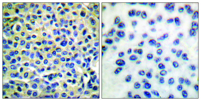 Anti-LIMK1 antibody produced in rabbit affinity isolated antibody