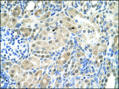 Anti-SLC9A9 antibody produced in rabbit affinity isolated antibody