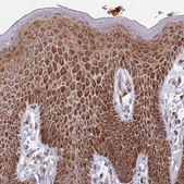 Anti-PRKCH antibody produced in rabbit Prestige Antibodies&#174; Powered by Atlas Antibodies, affinity isolated antibody, buffered aqueous glycerol solution