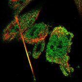 Anti-CBR3 antibody produced in rabbit Prestige Antibodies&#174; Powered by Atlas Antibodies, affinity isolated antibody, buffered aqueous glycerol solution