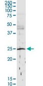 Anti-C1QB antibody produced in rabbit purified immunoglobulin, buffered aqueous solution