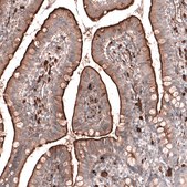 Anti-RAB27B antibody produced in rabbit Prestige Antibodies&#174; Powered by Atlas Antibodies, affinity isolated antibody, buffered aqueous glycerol solution