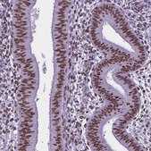 Monoclonal Anti-REST antibody produced in mouse Prestige Antibodies&#174; Powered by Atlas Antibodies, clone CL0381, purified immunoglobulin, buffered aqueous glycerol solution