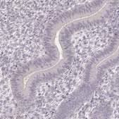 Anti-LY6K antibody produced in rabbit Prestige Antibodies&#174; Powered by Atlas Antibodies, affinity isolated antibody, buffered aqueous glycerol solution