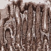 Anti-LSR antibody produced in rabbit Prestige Antibodies&#174; Powered by Atlas Antibodies, affinity isolated antibody, buffered aqueous glycerol solution