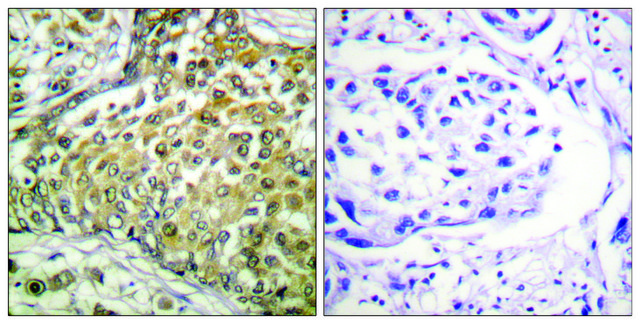 Anti-p53 (Acetyl-Lys379), C-Terminal antibody produced in rabbit affinity isolated antibody