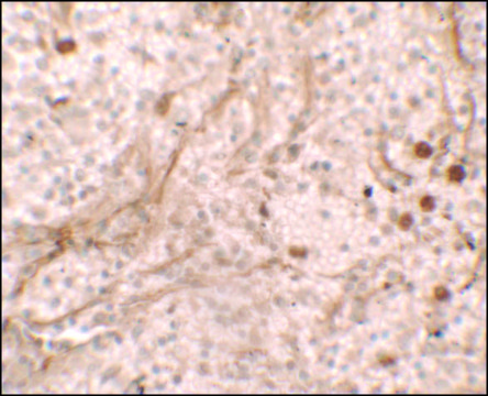 Anti-PIBF1 antibody produced in rabbit affinity isolated antibody