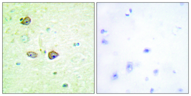 Anti-5-HT-1B antibody produced in rabbit affinity isolated antibody