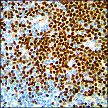 Anti-Cyclin D1 antibody, Rabbit monoclonal clone SP4, recombinant, expressed in proprietary host, tissue culture supernatant