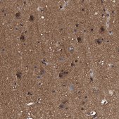 Anti-PSMD12 antibody produced in rabbit Prestige Antibodies&#174; Powered by Atlas Antibodies, affinity isolated antibody, buffered aqueous glycerol solution